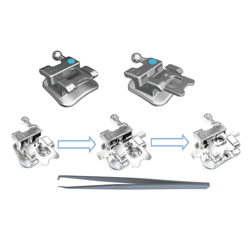 Bondable Self-Ligating Bracket  with simple rotational control (Include ligating instrument) , 80g Mesh Base  5-5 /20 Pcs (Unit)